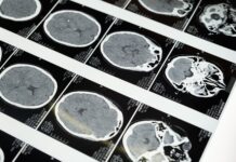Brain-scan imagery from a current Research2Reality science article